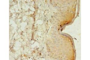 Immunohistochemistry of paraffin-embedded human skin tissue using ABIN7170464 at dilution of 1:100 (SPANXC Antikörper  (AA 1-97))