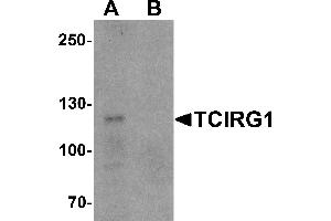 Western blot analysis of TCIRG1 in EL4 cell lysate with TCIRG1 antibody at 0.