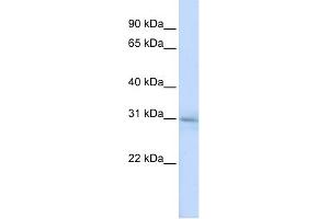 WB Suggested Anti-METTL5 Antibody Titration: 0.