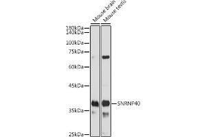 Western blot analysis of extracts of various cell lines, using SNRNP40 antibody (ABIN7270361) at 1:1000 dilution. (SNRNP40 Antikörper)