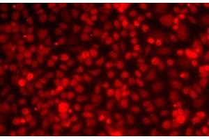 Immunofluorescence analysis of MCF7 cells using ILF2 Polyclonal Antibody (ILF2 Antikörper)