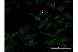 Immunofluorescence of monoclonal antibody to BRAF on HeLa cell. (BRAF Antikörper  (AA 138-231))