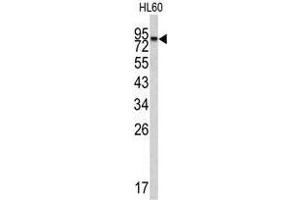 Image no. 1 for anti-Carboxypeptidase X (M14 Family), Member 2 (CPXM2) (N-Term) antibody (ABIN452869)