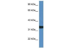 Western Blot showing ACER1 antibody used at a concentration of 1 ug/ml against HCT15 Cell Lysate (ACER1 Antikörper  (C-Term))