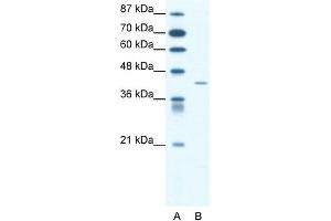 WB Suggested Anti-SSTR4 Antibody Titration: 1. (SSTR4 Antikörper  (Middle Region))