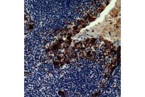 Immunohistochemical analysis of CD21 staining in human tonsil formalin fixed paraffin embedded tissue section. (CD21 Antikörper)