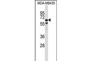 TRIM39 Antibody (Center) (ABIN657389 and ABIN2846430) western blot analysis in MDA-M cell line lysates (35 μg/lane). (TRIM39 Antikörper  (AA 248-277))