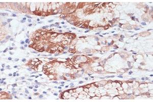 Immunohistochemistry of paraffin-embedded Human stomach using LYZ Polyclonal Antibody at dilution of 1:100 (40x lens). (LYZ Antikörper)
