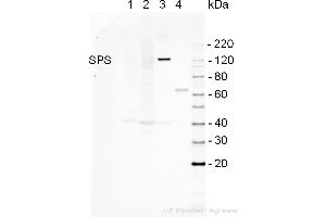 Western Blotting (WB) image for anti-Sucrose Phosphate Synthase (SPS) antibody (ABIN2559391) (Sucrose Phosphate Synthase Antikörper)