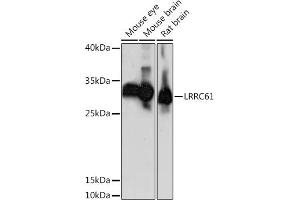 Western blot analysis of extracts of various cell lines, using LRRC61 Rabbit pAb (ABIN7268223) at 1:1000 dilution. (LRRC61 Antikörper  (AA 1-259))