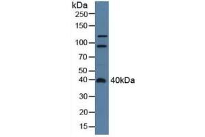 ADAP2 Antikörper  (AA 49-360)