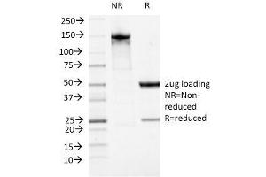SDS-PAGE Analysis Purified ATRX Mouse Monoclonal Antibody (23c). (ATRX Antikörper)