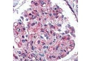 Immunohistochemistry (IHC) image for anti-Ubiquitin (Ub) (AA 1-32) antibody (ABIN3029419)