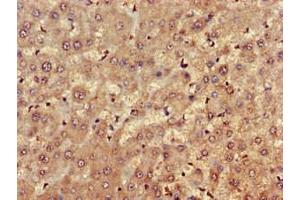 Immunohistochemistry of paraffin-embedded human liver tissue using ABIN7152690 at dilution of 1:100 (FARP1 Antikörper  (AA 1-300))