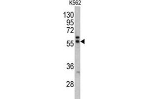 Western Blotting (WB) image for anti-Preferentially Expressed Antigen in Melanoma (PRAME) antibody (ABIN3002772) (PRAME Antikörper)