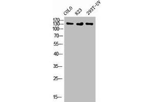 Western Blot analysis of COLO 823 293T-UV cells using Phospho-Flt-1 (Y1048) Polyclonal Antibody (FLT1 Antikörper  (pTyr1048))