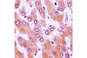 Immunohistochemistry (IHC) image for anti-Wilms Tumor 1 (WT1) antibody (ABIN7308510) (WT1 Antikörper)