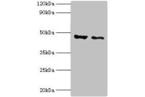 Western blot All lanes: PLIN2 antibody at 4 μg/mL Lane 1: HepG2 whole cell lysate Lane 2: Hela whole cell lysate Secondary Goat polyclonal to rabbit IgG at 1/10000 dilution Predicted band size: 48 kDa Observed band size: 48 kDa (ADRP Antikörper  (AA 168-437))