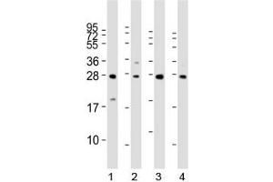 Western Blotting (WB) image for anti-Lin-28 Homolog B (LIN28B) (AA 95-128) antibody (ABIN3031627)