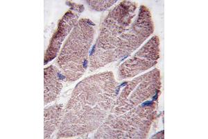 Formalin-fixed and paraffin-embedded human skeletal muscle tissue reacted with PTPD1 antibody (Center), which was peroxidase-conjugated to the secondary antibody, followed by DAB staining.