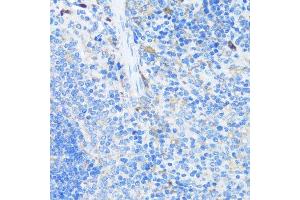 Immunohistochemistry (Paraffin-embedded Sections) (IHC (p)) image for anti-Eukaryotic Translation Initiation Factor 3 Subunit J (EIF3S1) (AA 1-258) antibody (ABIN6140070)
