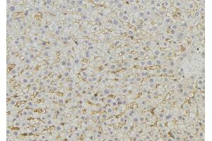 ABIN6274743 at 1/100 staining Mouse liver tissue by IHC-P.