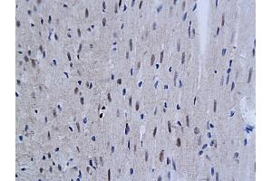 Formalin-fixed and paraffin embedded mouse myocardial tissue labeled with Anti SnoN Polyclonal Antibody, Unconjugated (ABIN760196) followed by conjugation to the secondary antibody and DAB staining