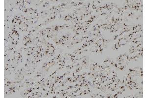 ABIN6279505 at 1/100 staining Human lung tissue by IHC-P.