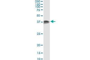 Immunoprecipitation of PRKRA transfected lysate using anti-PRKRA monoclonal antibody and Protein A Magnetic Bead , and immunoblotted with PRKRA MaxPab rabbit polyclonal antibody. (PRKRA Antikörper  (AA 1-313))