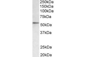 Western Blotting (WB) image for anti-Histone Deacetylase 1 (HDAC1) (AA 385-396) antibody (ABIN1101988) (HDAC1 Antikörper  (AA 385-396))