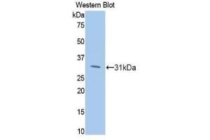Detection of Recombinant PIK3Cb, Human using Polyclonal Antibody to Phosphoinositide-3-Kinase Catalytic Beta Polypeptide (PIK3Cb) (PIK3CB Antikörper  (AA 807-1070))