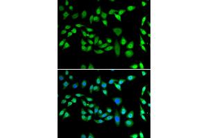 Immunofluorescence analysis of U2OS cells using DNAJB6 antibody. (DNAJB6 Antikörper)