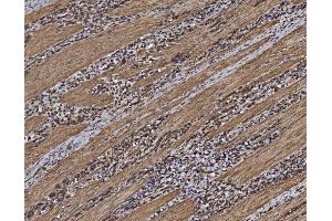 IHC analysis of EIF5 using anti-EIF5 antibody (ABIN7599722).