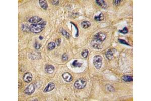 Immunohistochemistry (IHC) image for anti-Tuberous Sclerosis 2 (TSC2) (AA 1776-1805) antibody (ABIN3029331)