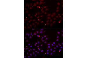 Immunofluorescence analysis of HeLa cells using CST2 antibody. (CST2 Antikörper)