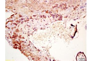 Formalin-fixed and paraffin embedded human placenta labeled with Anti-IL-7 Polyclonal Antibody, Unconjugated (ABIN734783) at 1:200 followed by conjugation to the secondary antibody and DAB staining (IL-7 Antikörper  (AA 51-154))