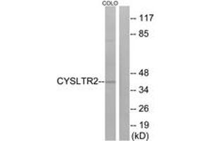Western blot analysis of extracts from COLO cells, using CYSLTR2 Antibody.