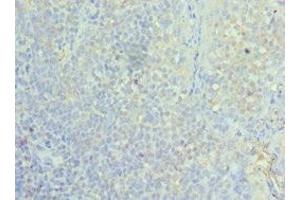Immunohistochemistry of paraffin-embedded human tonsil tissue using ABIN7155295 at dilution of 1:100 (ASF1A Antikörper  (AA 1-204))
