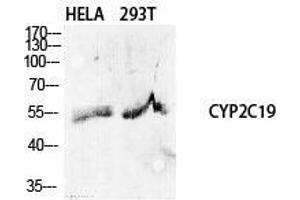 Western Blotting (WB) image for anti-Cytochrome P450, Family 2, Subfamily C, Polypeptide 19 (CYP2C19) (Internal Region) antibody (ABIN6282222)