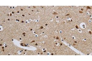 Immunohistochemistry of paraffin-embedded Human brain tissue using CMTM8 Polyclonal Antibody at dilution 1:40