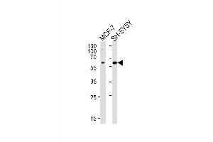 ZBTB22 Antikörper  (C-Term)