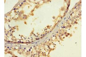 Immunohistochemistry of paraffin-embedded human testis tissue using ABIN7152269 at dilution of 1:100 (EXD2 Antikörper  (AA 137-245))