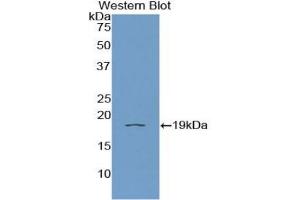 Detection of Recombinant IL11Ra, Human using Polyclonal Antibody to Interleukin 11 Receptor Alpha (IL11Ra) (IL11RA Antikörper  (AA 59-220))