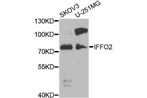 Western blot analysis of extracts of various cell lines, using IFFO2 antibody (ABIN2563343) at 1:1000 dilution. (IFFO2 Antikörper)
