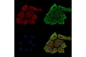 Phospho-RAB7L1 (Thr71) Antibody staining HepG2 cells(serum starvation treatment) by IF/ICC. (RAB7L1 Antikörper  (pThr71))