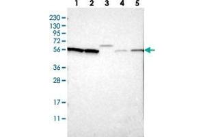 Western blot analysis of Lane 1: RT-4, Lane 2: U-251 MG, Lane 3: Human Plasma, Lane 4: Liver, Lane 5: Tonsil with SLC15A4 polyclonal antibody  at 1:250-1:500 dilution. (SLC15A4 Antikörper)