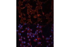 Immunofluorescence analysis of NIH/3T3 cells using SLC25 antibody (ABIN6132766, ABIN6147924, ABIN6147926 and ABIN6217967) at dilution of 1:100. (SLC25A27 Antikörper  (AA 1-245))