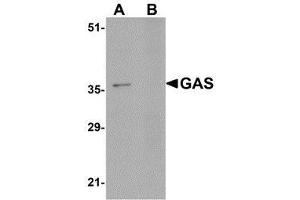 Western blot analysis of GAS in EL4 cell lysate in (A) the absence and (B) the presence of blocking peptide with AP30357PU-N GAS antibody at 1μg/ml. (Gastrin Antikörper  (C-Term))
