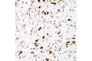 Immunohistochemistry (IHC) image for anti-Tumor Protein P53 (TP53) antibody (ABIN3017541) (p53 Antikörper)