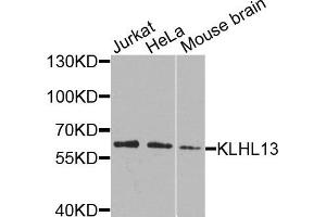 Western blot analysis of extracts of various cells, using KLHL13 antibody. (KLHL13 Antikörper)